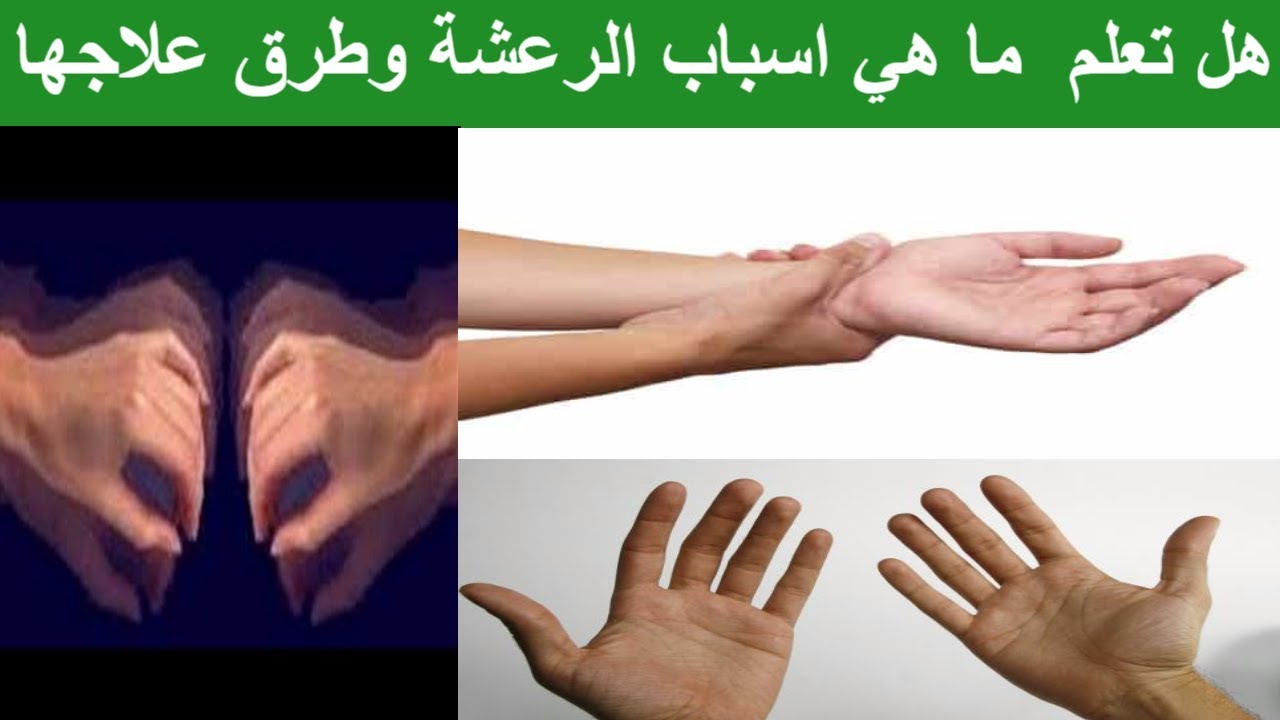 اسباب رعشة اليد - اعراض رعشه اليد والسبب وكيفيه العلاج 6085