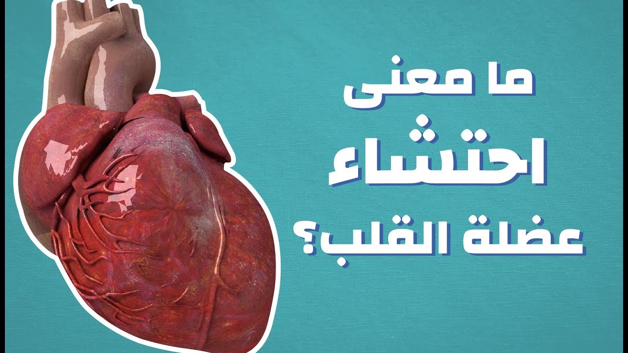 اسباب واعراض احتشاء عضلة القلب - ما هي اعراض عضله القلب 5950 3